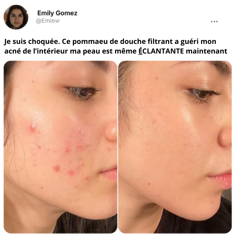 Pommeau de douche plus filtre ultime pour prendre soin de sa peau, de ses cheveux et économiser sur sa facture d'eau  élimine les toxines anticalcaire, spa à la maison, guéri les acné 